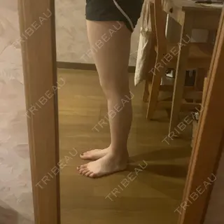 53日目の経過画像（2枚目）