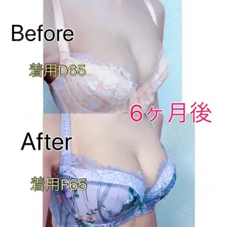 204日目の経過画像（2枚目）