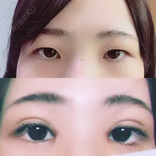 7日目の経過画像（1枚目）