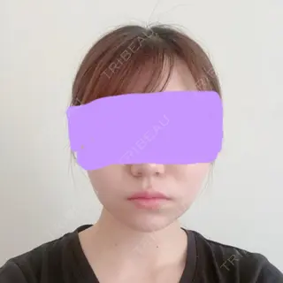 131日目の経過画像（1枚目）