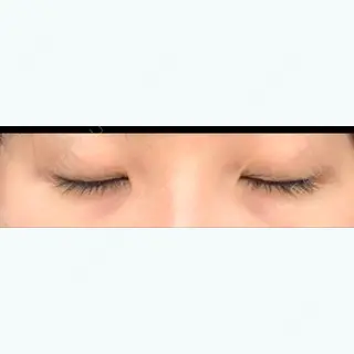 89日目の経過画像（2枚目）