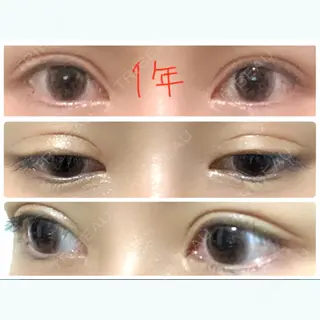 370日目の経過画像（1枚目）