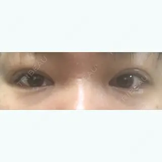 9日目の経過画像（1枚目）