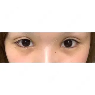156日目の経過画像（1枚目）
