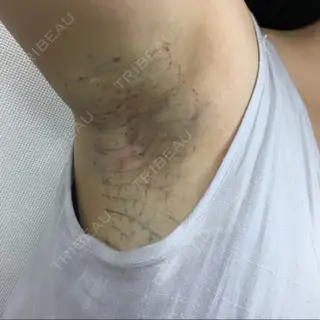 0日目の経過画像（1枚目）