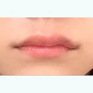 2日目の経過画像（1枚目）