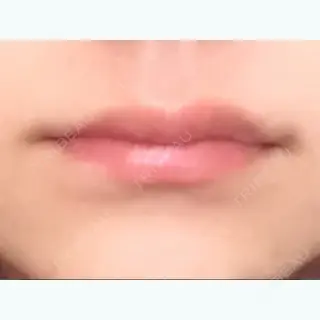 3日目の経過画像（1枚目）
