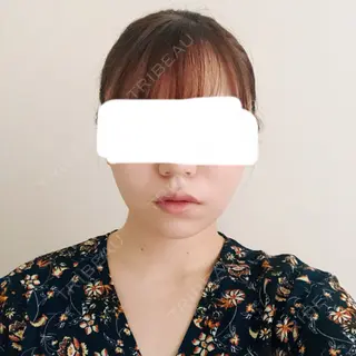 139日目の経過画像（1枚目）