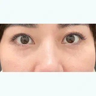 250日目の経過画像（1枚目）