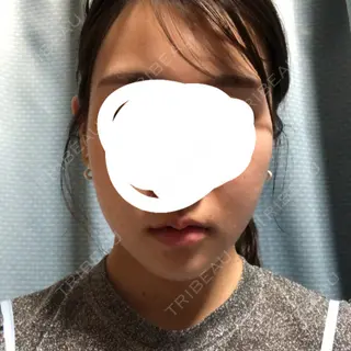 181日目の経過画像（2枚目）