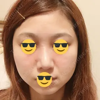 25日目の経過画像（1枚目）