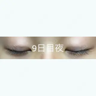 8日目の経過画像（2枚目）
