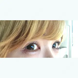 87日目の経過画像（1枚目）