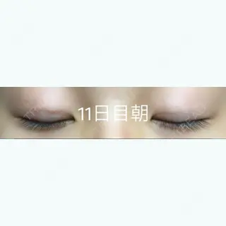 10日目の経過画像（2枚目）