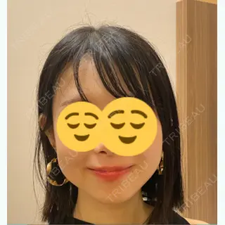 141日目の経過画像（1枚目）