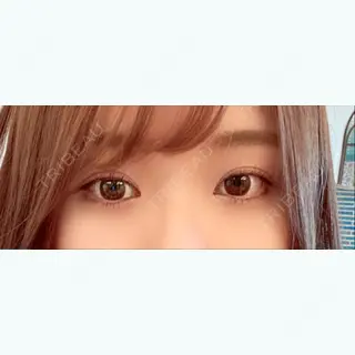 179日目の経過画像（1枚目）