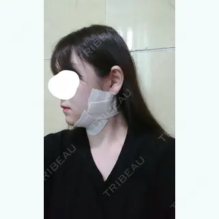 1日目の経過画像（3枚目）