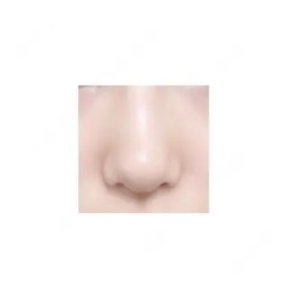 9日目の経過画像（1枚目）