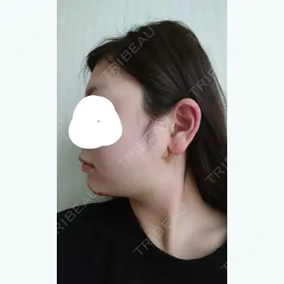 3日目の経過画像（3枚目）