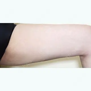 115日目の経過画像（2枚目）