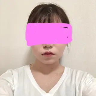 165日目の経過画像（1枚目）