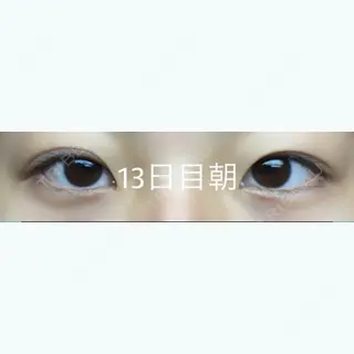 12日目の経過画像（1枚目）