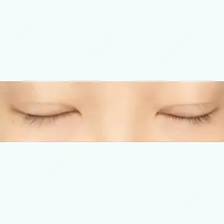 28日目の経過画像（2枚目）