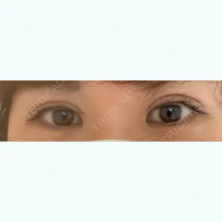236日目の経過画像（1枚目）