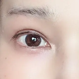 169日目の経過画像（1枚目）