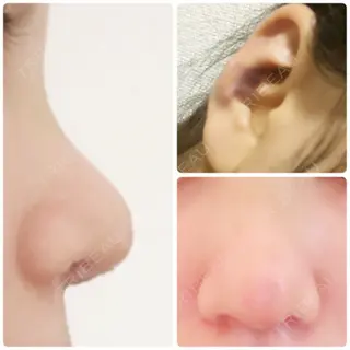 4日目の経過画像（1枚目）