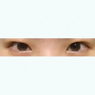 185日目の経過画像（1枚目）