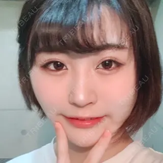 110日目の経過画像（1枚目）