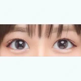 112日目の経過画像（1枚目）