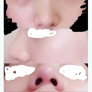 47日目の経過画像（1枚目）