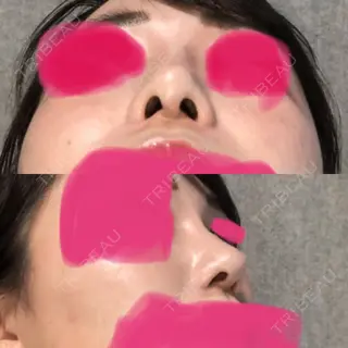 247日目の経過画像（2枚目）