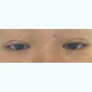 19日目の経過画像（2枚目）