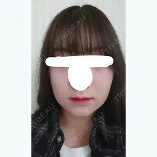 7日目の経過画像（1枚目）
