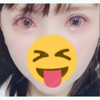 10日目の経過画像（1枚目）