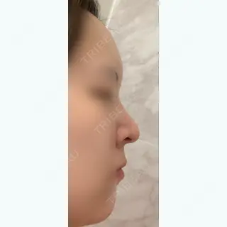 202日目の経過画像（1枚目）