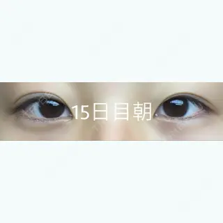 14日目の経過画像（1枚目）