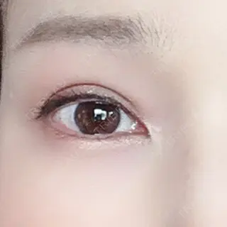 186日目の経過画像（1枚目）