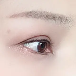 186日目の経過画像（2枚目）