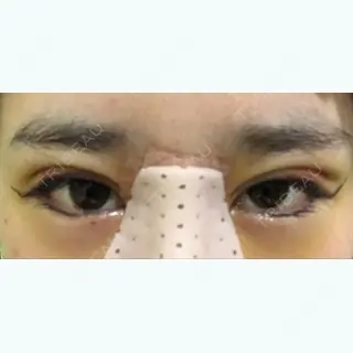 3日目の経過画像（1枚目）