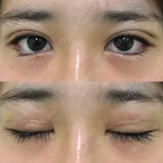 7日目の経過画像（1枚目）