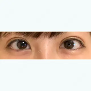 112日目の経過画像（2枚目）