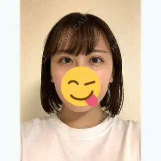 112日目の経過画像（1枚目）