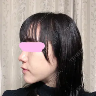 93日目の経過画像（3枚目）