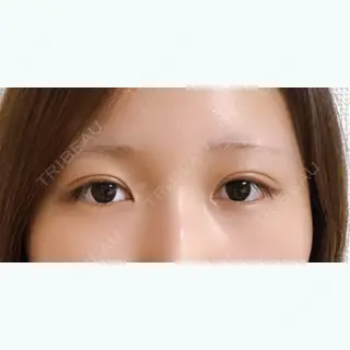 22日目の経過画像（1枚目）