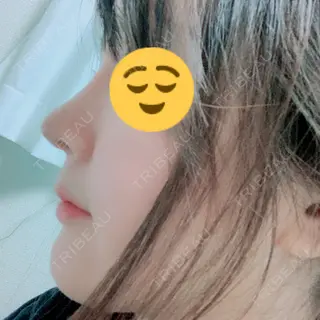 197日目の経過画像（1枚目）