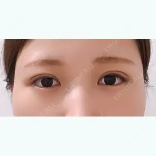 23日目の経過画像（1枚目）